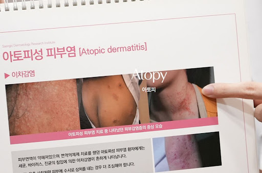 생기한의원이 정리한 아토피 팔 접히는 부위 증상 특징